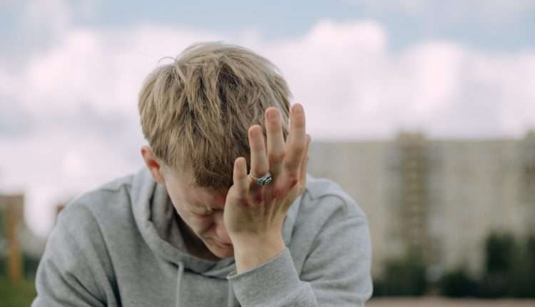 a man with bruised knuckles having a headache